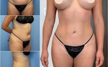 Best Doctors in Dubai for Body Contouring: Sculpting Confidence, One Body at a Time