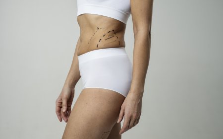 Experience Total Body Transformation with Best Liposuction Doctors in Dubai