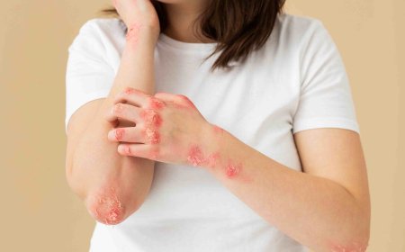 Ivercor 12 mg: One Tablet, Full Parasite Protection