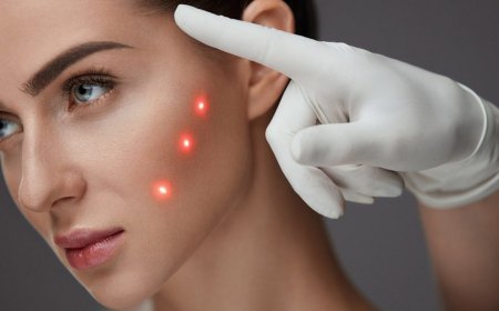 Riyadh’s Laser Hair Removal Tips