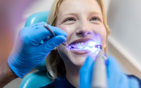 How Long Does Teeth Whitening Last? 5 Factors That Affect It