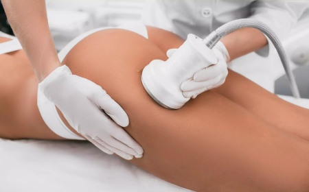 Riyadh Venus Legacy Insights