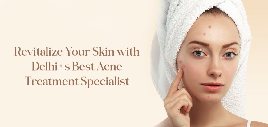 Chemical Peel Treatment in Delhi – Reveal Radiant, Younger-Looking Skin at Iksana Wellness