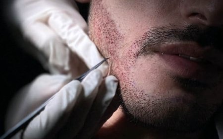 Jeddah’s Guide to Beard Hair Transplantation