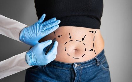 Jeddah Liposuction: Sculpt Your Ideal Shape