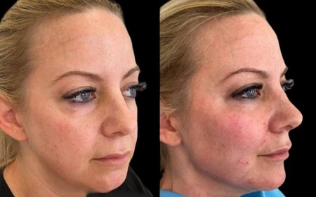 Why the Best Aesthetic Clinics in Dubai Are Trusted by Cheek Fillers Celebrities