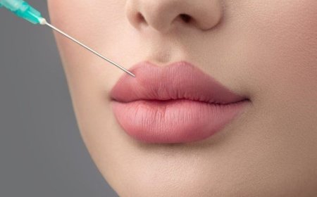 Top Reasons to Consider Best Aesthetic Clinics in Dubai for Russian Lip Fillers