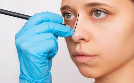 هل تبحث عن تجميل الأنف في الرياض؟ استشارة مجانية الآن!