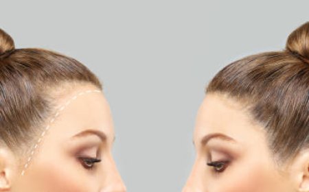 احجز الآن زراعة الشعر في الرياض واحصل على استشارة مجانية