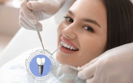 Dental Implants to Replace Retained Baby Teeth in Adults