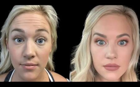 Post-Botox Skincare Tips from the Best Aesthetic Clinics in dubai