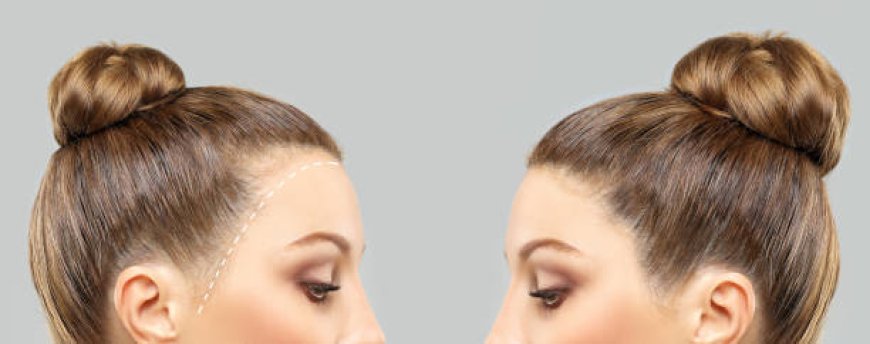 احجز الآن زراعة الشعر في الرياض واحصل على استشارة مجانية