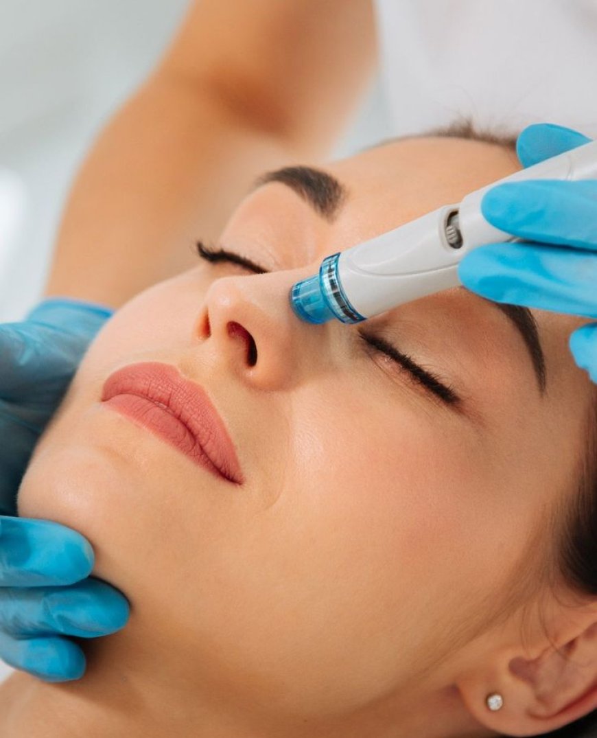 Hydrodermabrasion Facial in Chelsea, London – Reveal Glowing, Hydrated Skin